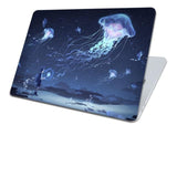 Coque MacBook Air - Naruto